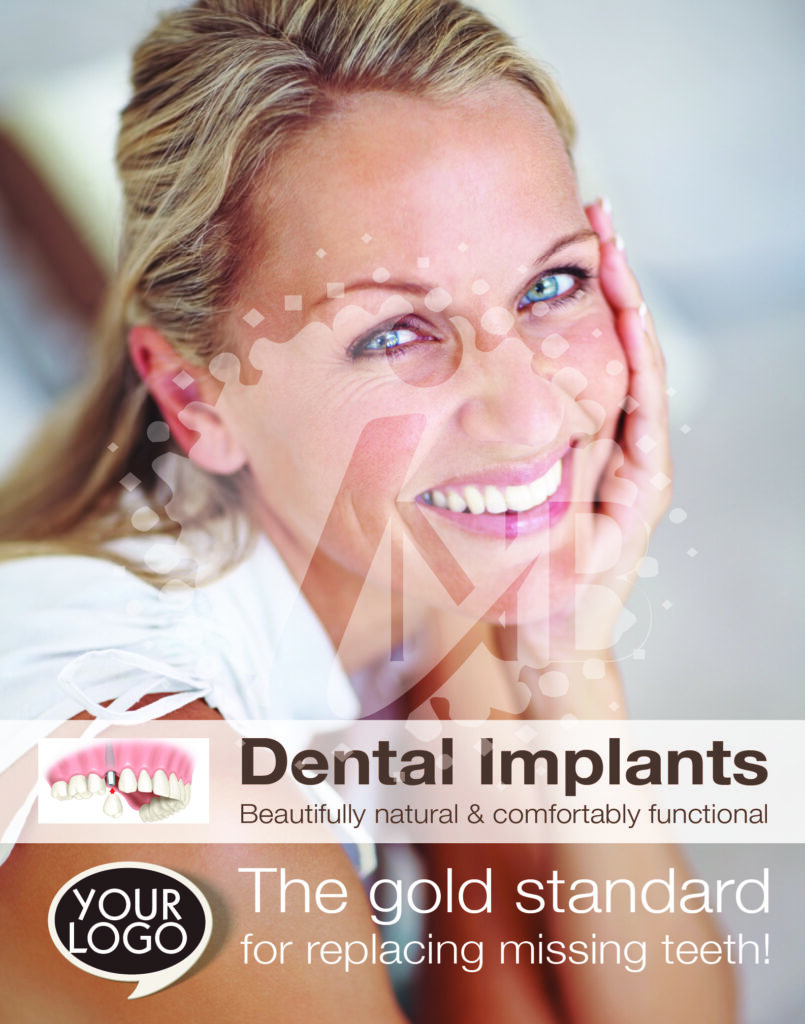 Perfect Smile on Woman Dental Implant Poster 