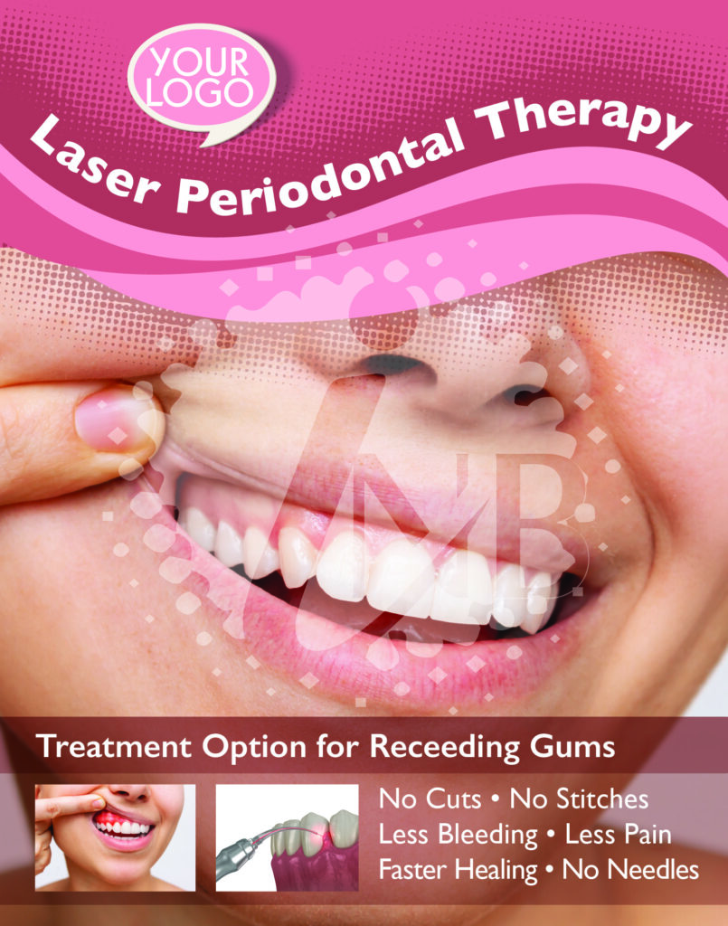 Dental Laser Periodontal Therapy Poster 